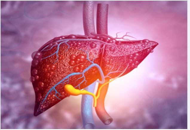 4 dấu hiệu thường gặp khi bị suy giảm chức năng gan