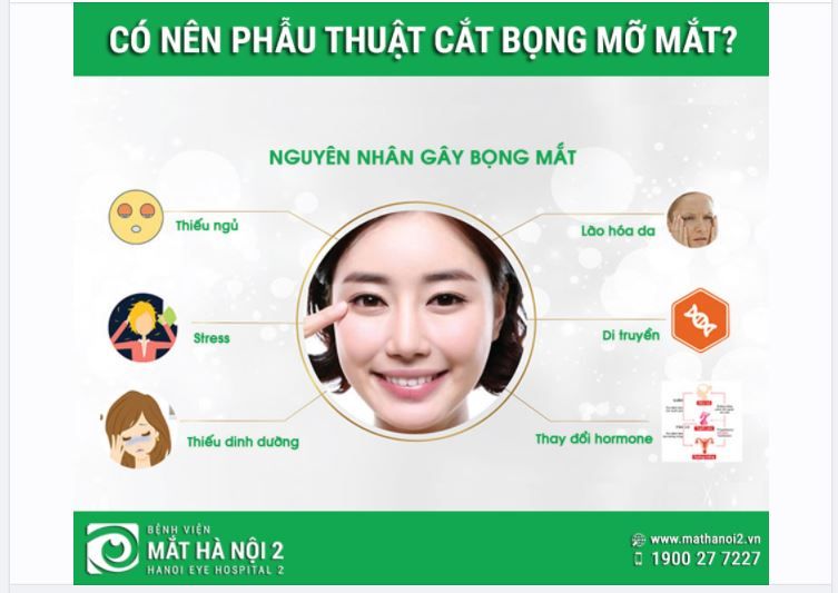 CÓ NÊN PHẪU THUẬT CẮT BỌNG MỠ MẮT?