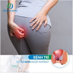 Bệnh Trĩ có tự khỏi được không?