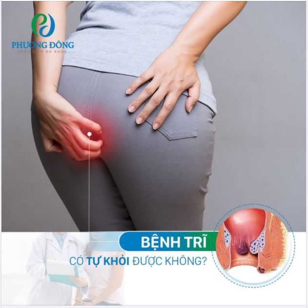 Bệnh Trĩ có tự khỏi được không?