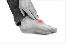 NGUYÊN NHÂN GÂY TĂNG AXIT URIC MÁU