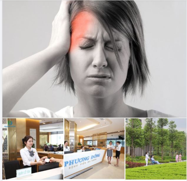 MIỄN PHÍ KHÁM ĐAU NỬA ĐẦU CÙNG CHUYÊN GIA BV BẠCH MAI