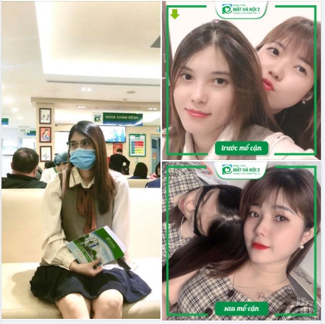 2 CHỊ EM CÙNG ĐI MỔ CẬN TẠI MẮT HÀ NỘI 2