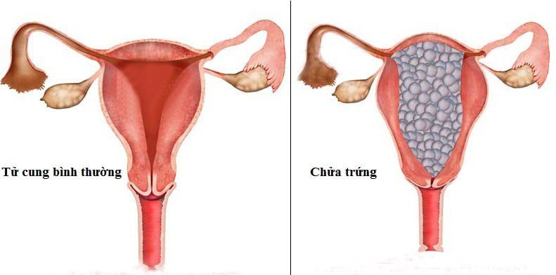 Tất cả những điều bạn cần biết nếu muốn mang thai