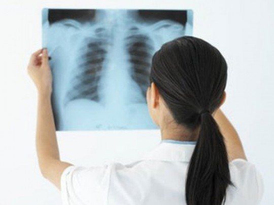 Dấu hiệu phát hiện cong vẹo dị tật cột sống bẩm sinh