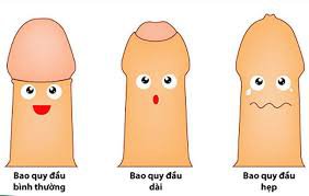 Có nên cắt bao quy đầu cho trẻ sơ sinh?