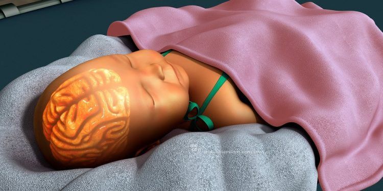 Những điều cần lưu ý khi chiếu đèn điều trị vàng da sơ sinh