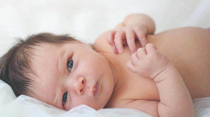 Chẩn đoán và điều trị tật dính khớp sọ sớm ở trẻ