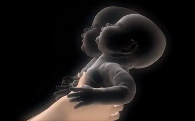 Hội chứng rung lắc ở trẻ em: Những điều cần biết