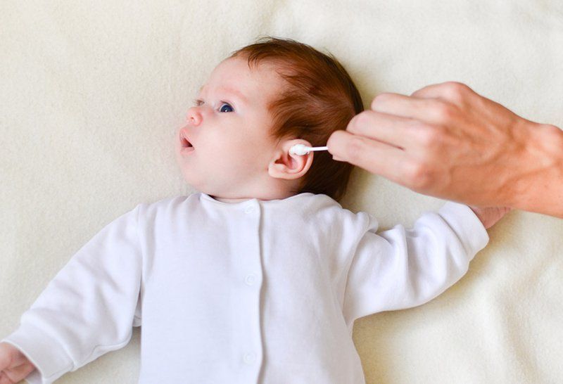 Dị tật rò luân nhĩ ở trẻ em