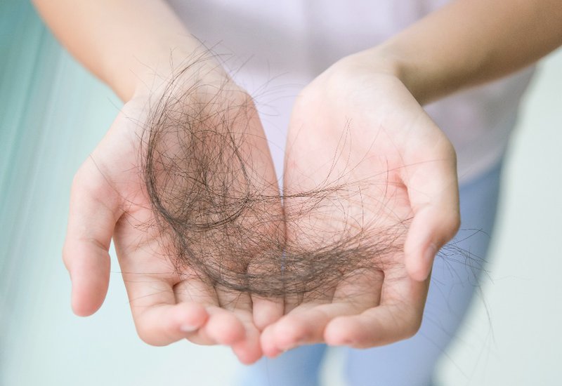 Có phải rụng tóc sau sinh là hiện tượng bình thường?