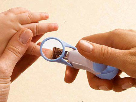 Nhận biết dấu hiệu bệnh chốc lây ngoài da ở trẻ nhỏ