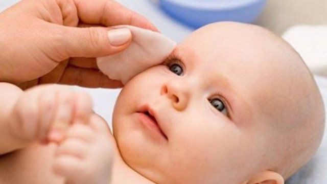 Xử trí khi trẻ sơ sinh bị tắc lệ đạo