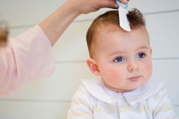 Rụng tóc từng mảng có đáng ngại?