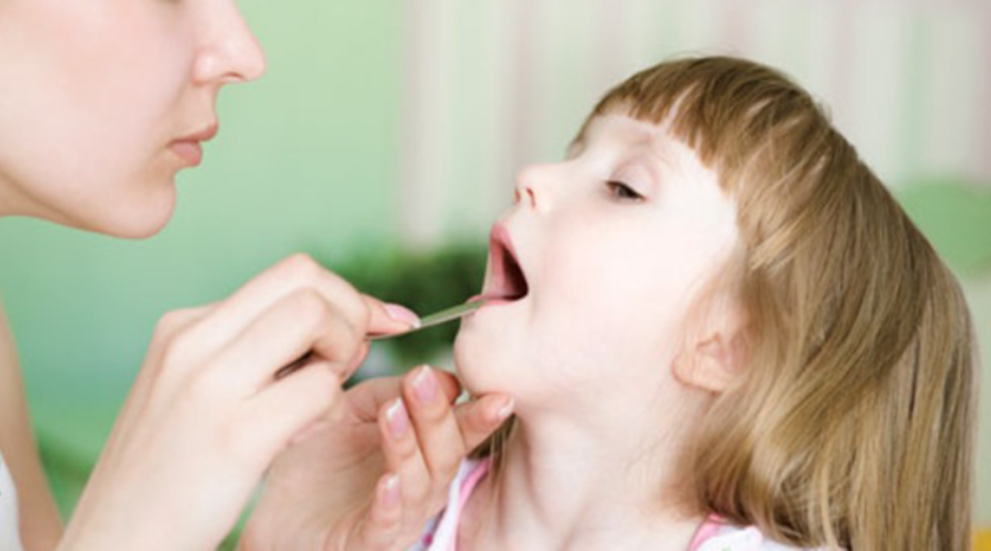 Chẩn đoán và điều trị viêm lưỡi bản đồ ở trẻ em