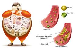 Kiểm tra cholesterol ở trẻ em