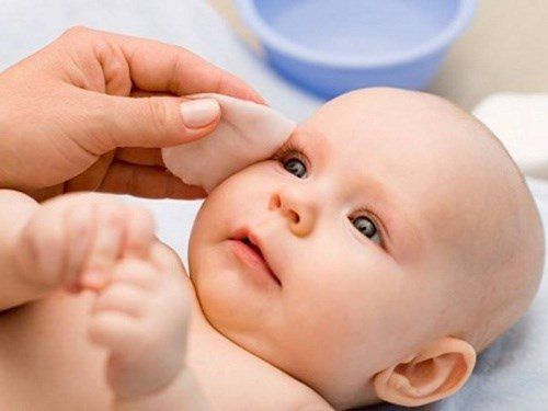 Cách xử trí chảy nước mắt sống do tắc lệ đạo ở trẻ