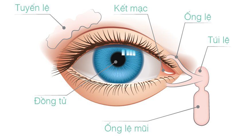 Chảy nước mắt sống do tắc lệ đạo ở trẻ