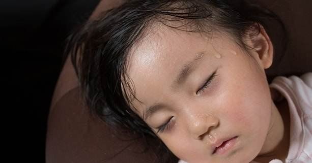 Trẻ đổ mồ hôi đầu nhiều có đáng lo?