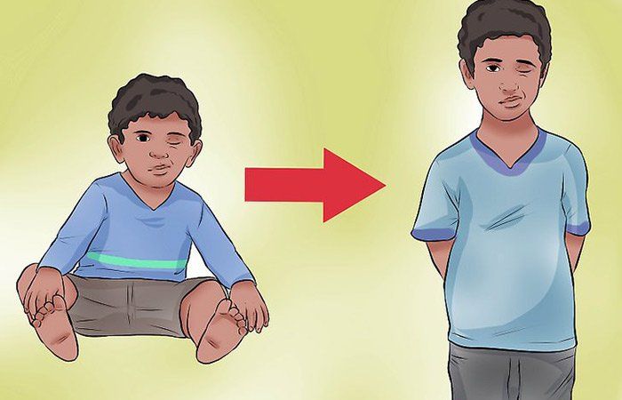 Rối loạn vận động ở trẻ em: Những điều cần biết