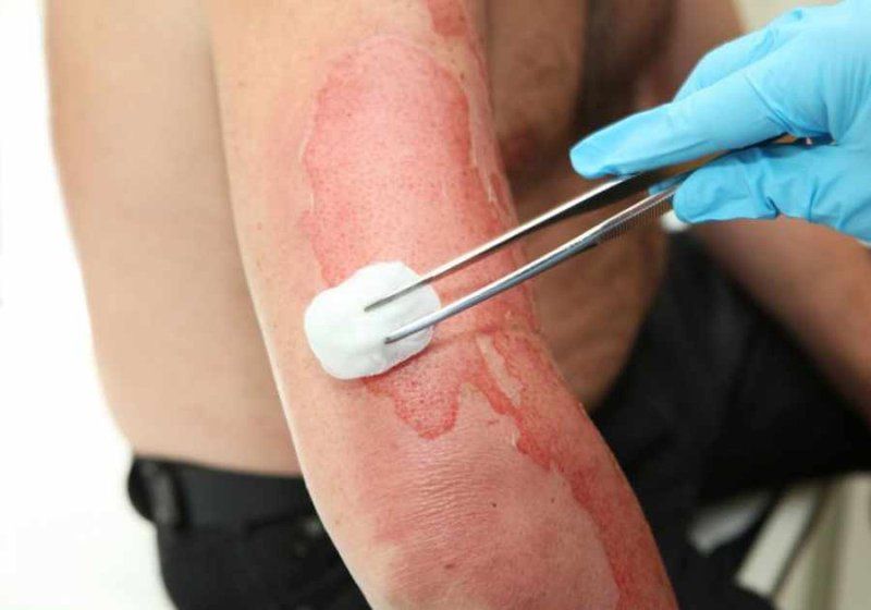 Cảnh giác bỏng và hạ thân nhiệt khi tắm cho trẻ sơ sinh mùa lạnh