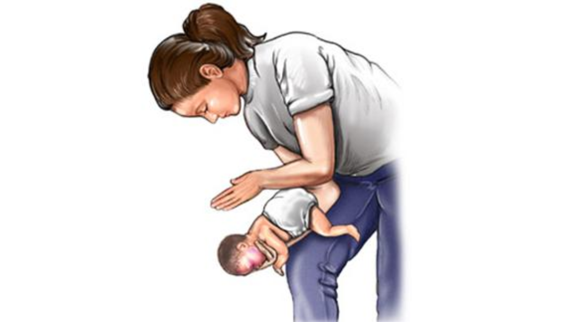 Phòng ngừa và xử trí dị vật đường thở ở trẻ em