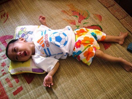 Những thông tin cần biết về tiêm vắc xin bại liệt