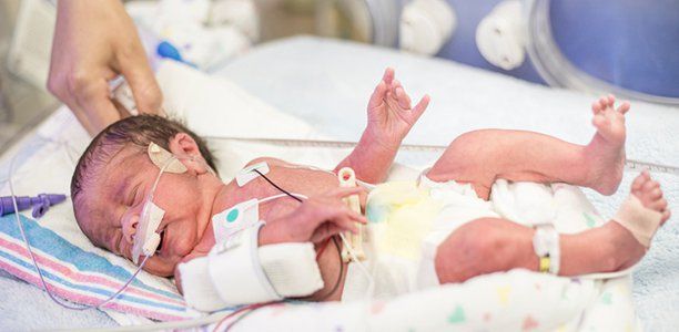 Tiêu chuẩn xuất viện với trẻ sinh non