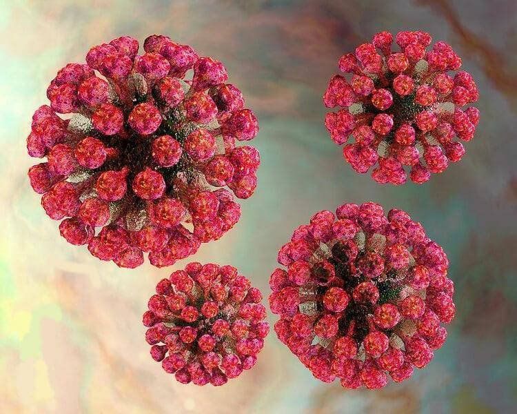 Tật đầu nhỏ ở trẻ: Những điều cần biết