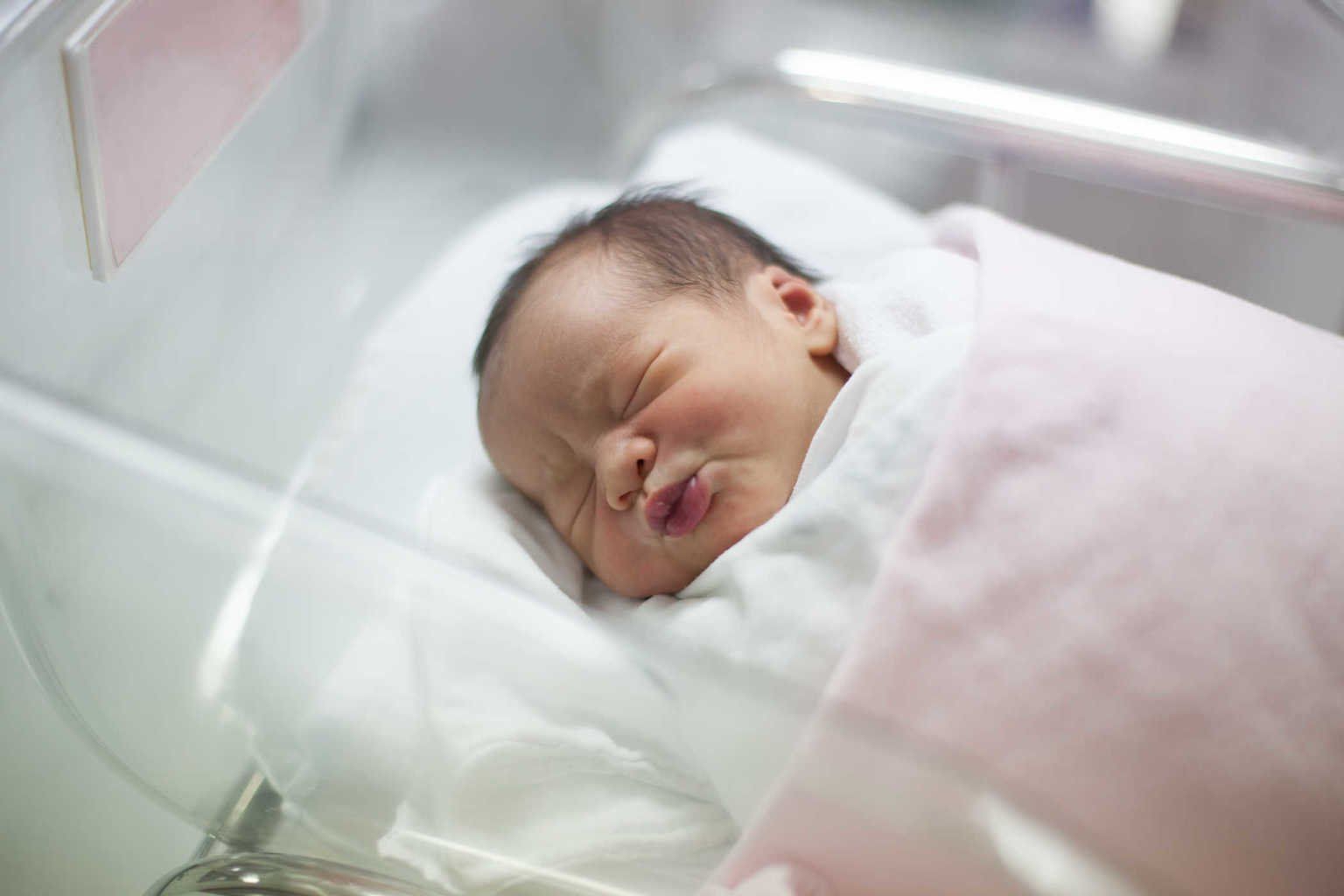 Trẻ bị tật đầu nhỏ, điều trị thế nào?