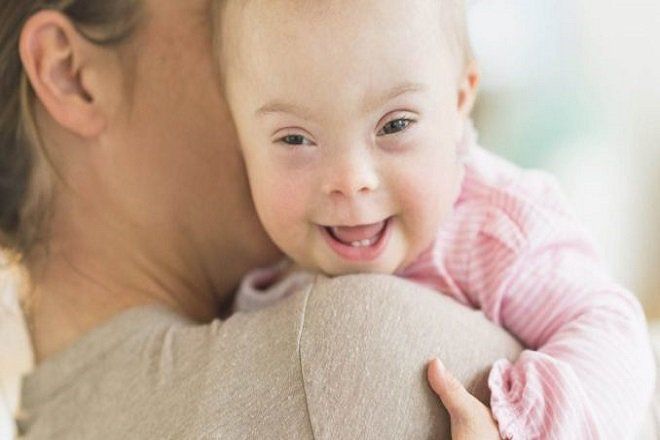Xét nghiệm bệnh down cho trẻ sơ sinh