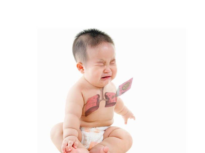 Điều trị viêm phổi ở trẻ em