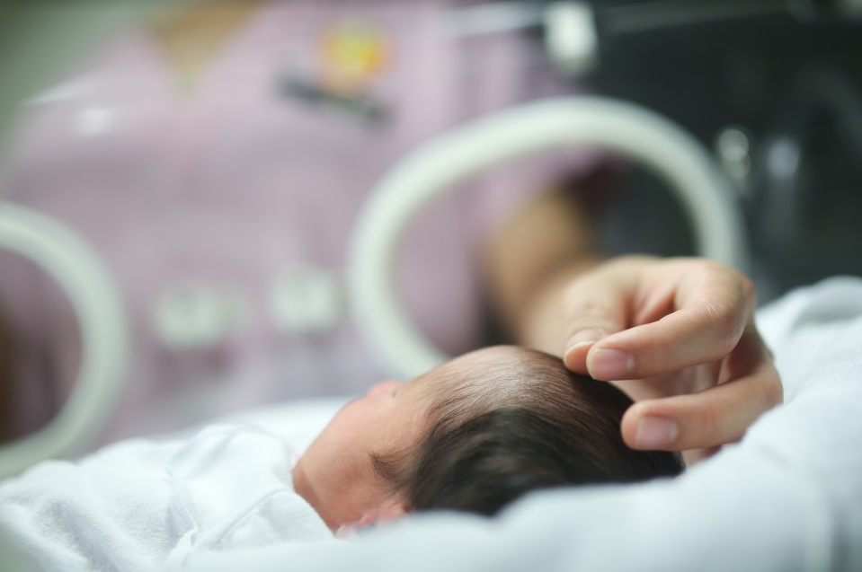 Những điều cần lưu ý khi chiếu đèn điều trị vàng da sơ sinh