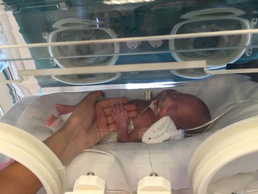 Sự phát triển của trẻ sinh non ở tuần 30 - 33