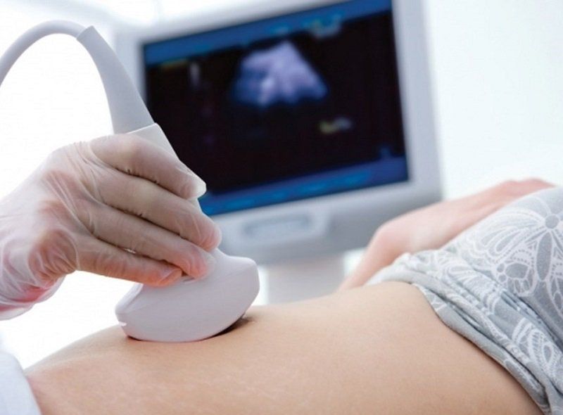 Thoát vị cuống rốn và hở thành bụng bẩm sinh