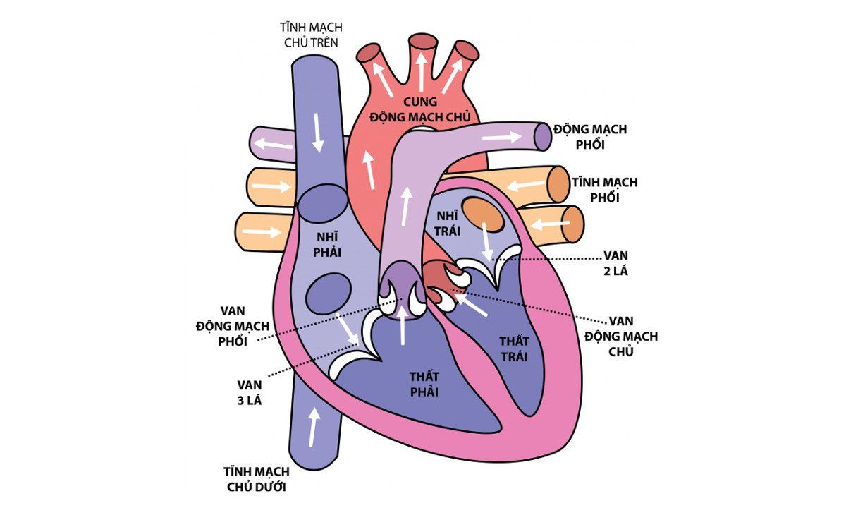 Tìm hiểu chứng hẹp động mạch phổi ở trẻ nhỏ