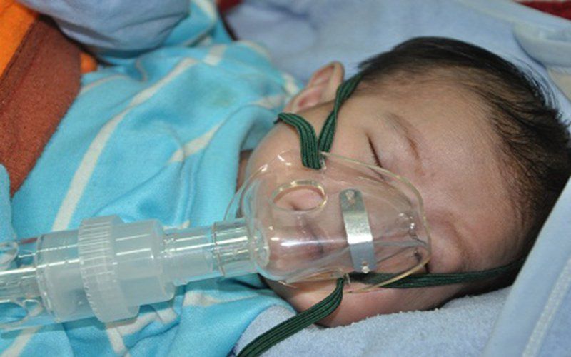 Trẻ sinh non bị mềm sụn thanh quản có biểu hiện gì?