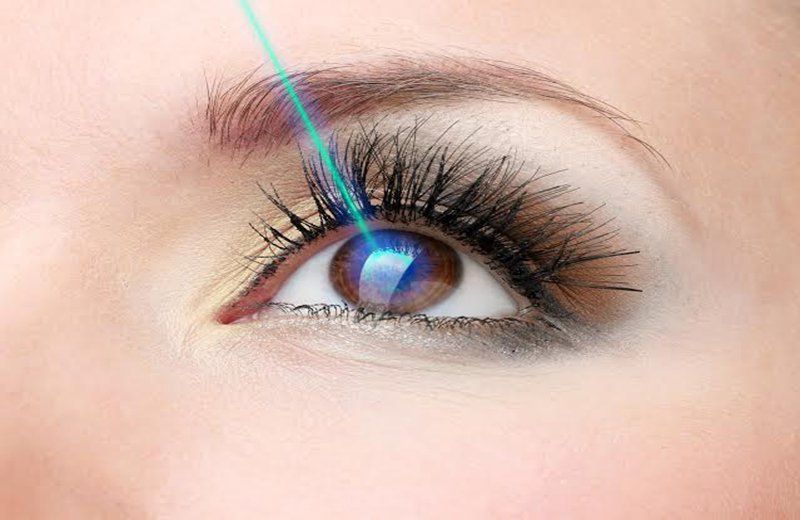 Trẻ có thể mổ cận thị bằng laser không?
