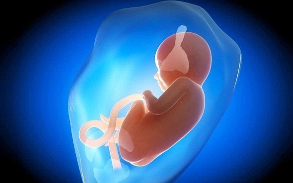 Chẩn đoán và điều trị dị tật bàn chân khoèo ở trẻ sơ sinh