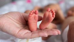 Cách nuôi trẻ sinh non tại khu vực chăm sóc đặc biệt NICU
