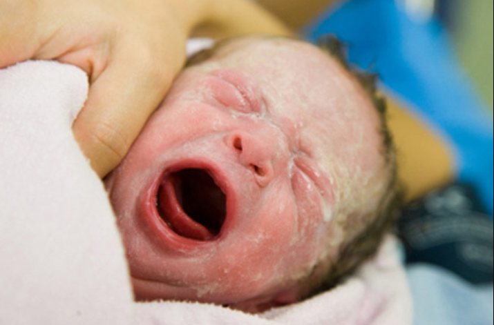 Bệnh màng trong ở trẻ sơ sinh: Những điều cần biết