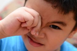 Trẻ viêm bờ mi có cần điều trị?