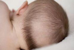 Trẻ sơ sinh rụng tóc có bình thường?