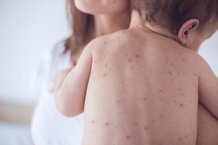 Đau họng ở trẻ sơ sinh và trẻ mới biết đi