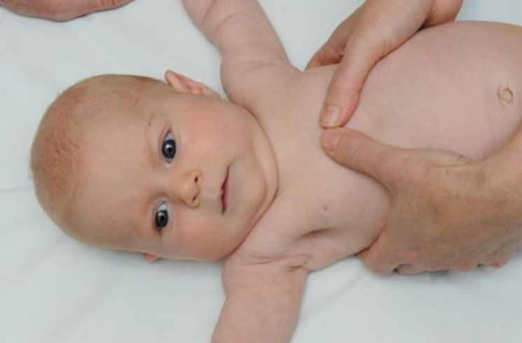 Có biện pháp phòng ngừa nào để tránh mũi xương ức nhô cao ở trẻ sơ sinh? 
