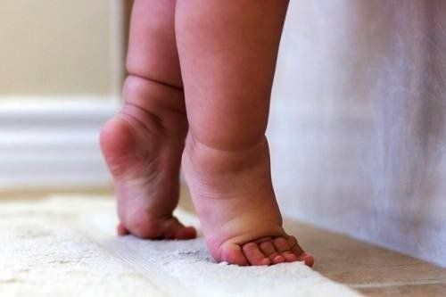 Trẻ đi nhón chân có cần can thiệp?