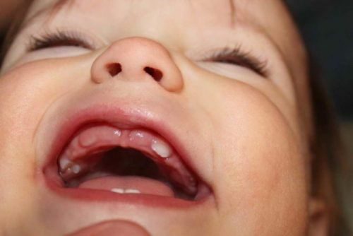 Trẻ 16 tháng tuổi: Chế độ dinh dưỡng và chăm sóc răng miệng