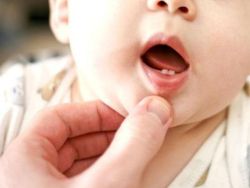 Cách chăm sóc nướu và răng mới mọc của bé