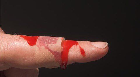 Bệnh Hemophilia là bệnh gì?