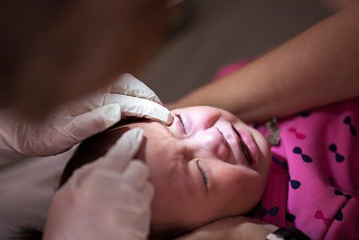 Trẻ viêm bờ mi có cần điều trị?